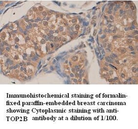 TOP2B Antibody from Signalway Antibody (39359) - Antibodies.com