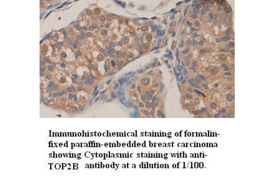 TOP2B Antibody from Signalway Antibody (39359) - Antibodies.com