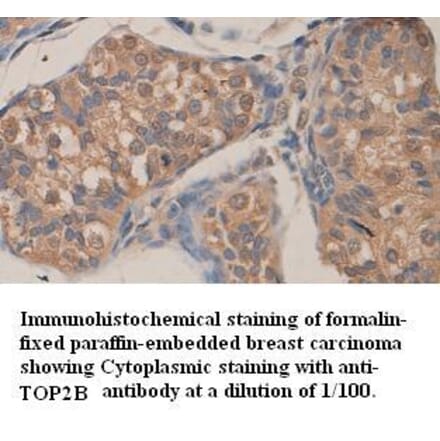 TOP2B Antibody from Signalway Antibody (39359) - Antibodies.com