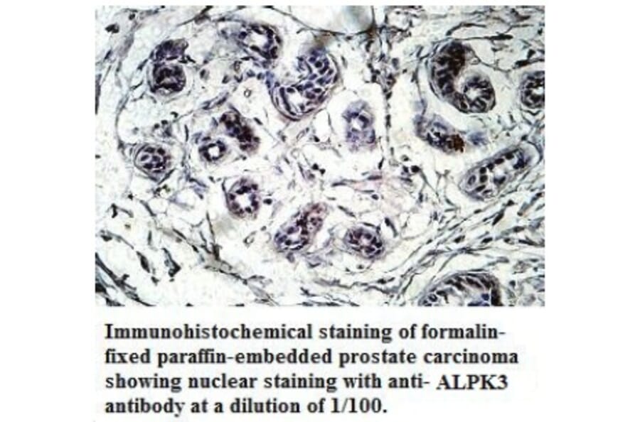 ALPK3 Antibody from Signalway Antibody (39717) - Antibodies.com