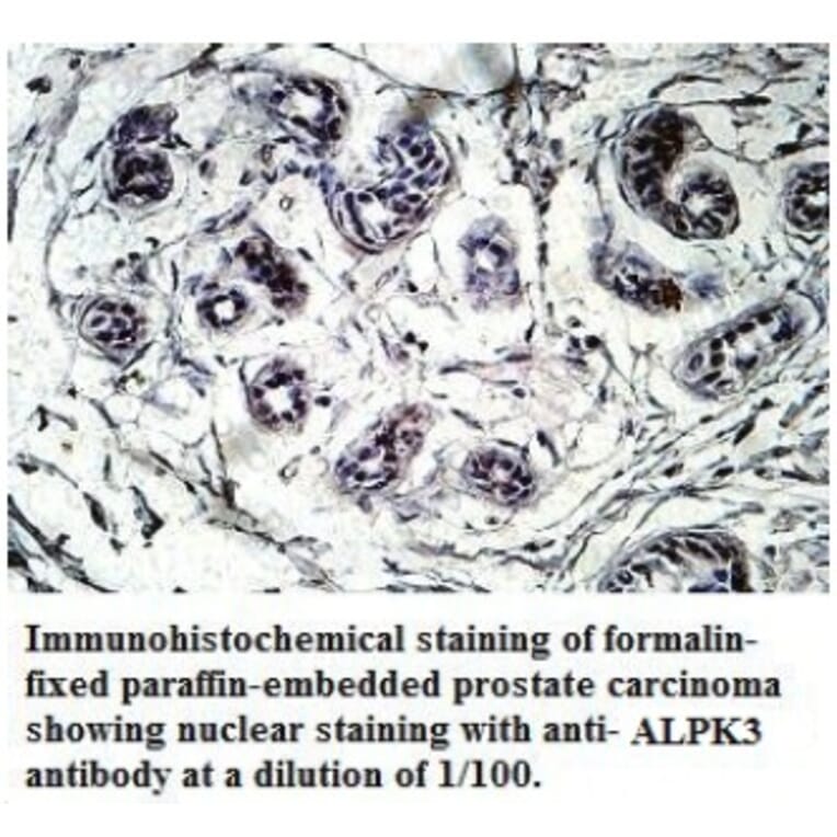 ALPK3 Antibody from Signalway Antibody (39717) - Antibodies.com