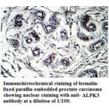 ALPK3 Antibody from Signalway Antibody (39717) - Antibodies.com