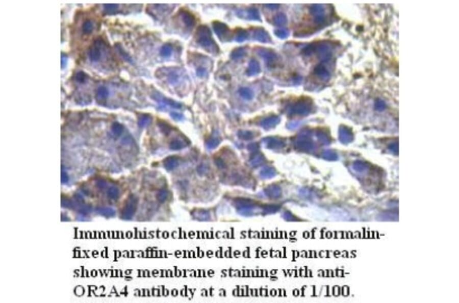 OR2A4 Antibody from Signalway Antibody (39719) - Antibodies.com