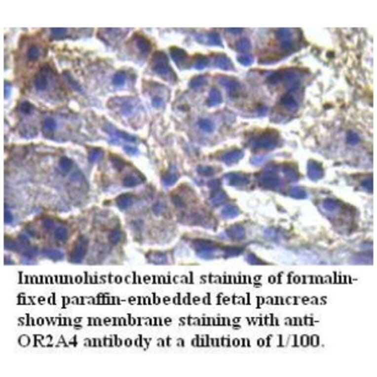 OR2A4 Antibody from Signalway Antibody (39719) - Antibodies.com