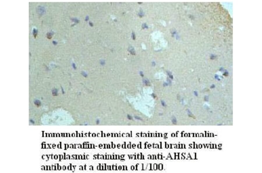AHSA1 Antibody from Signalway Antibody (39721) - Antibodies.com