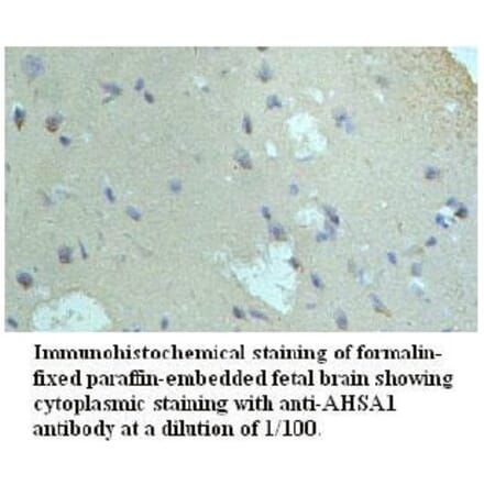 AHSA1 Antibody from Signalway Antibody (39721) - Antibodies.com