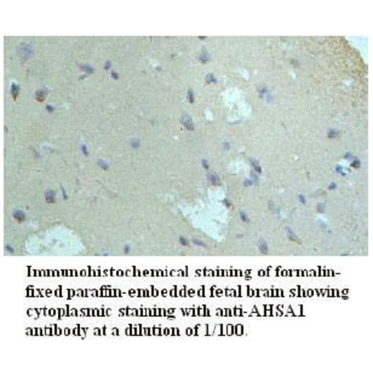 AHSA1 Antibody from Signalway Antibody (39721) - Antibodies.com