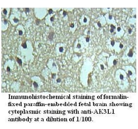AK3L1 Antibody from Signalway Antibody (39722) - Antibodies.com