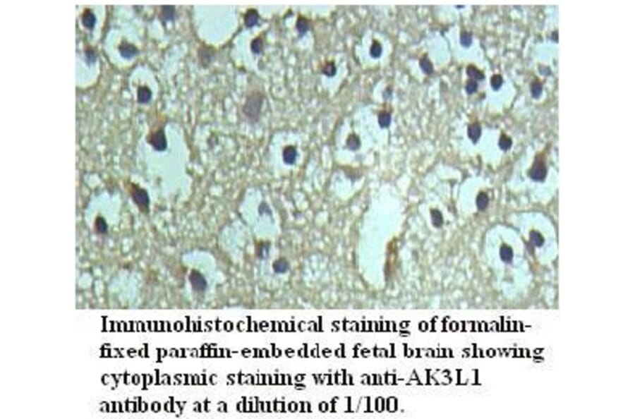 AK3L1 Antibody from Signalway Antibody (39722) - Antibodies.com