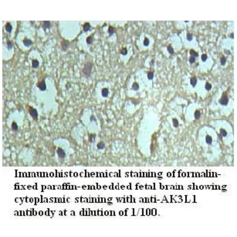 AK3L1 Antibody from Signalway Antibody (39722) - Antibodies.com