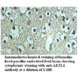 AK3L1 Antibody from Signalway Antibody (39722) - Antibodies.com