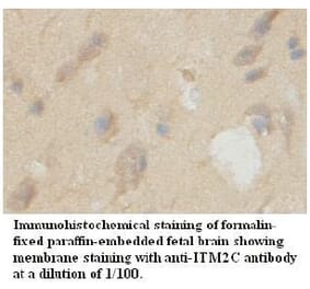 ITM2C Antibody from Signalway Antibody (39725) - Antibodies.com