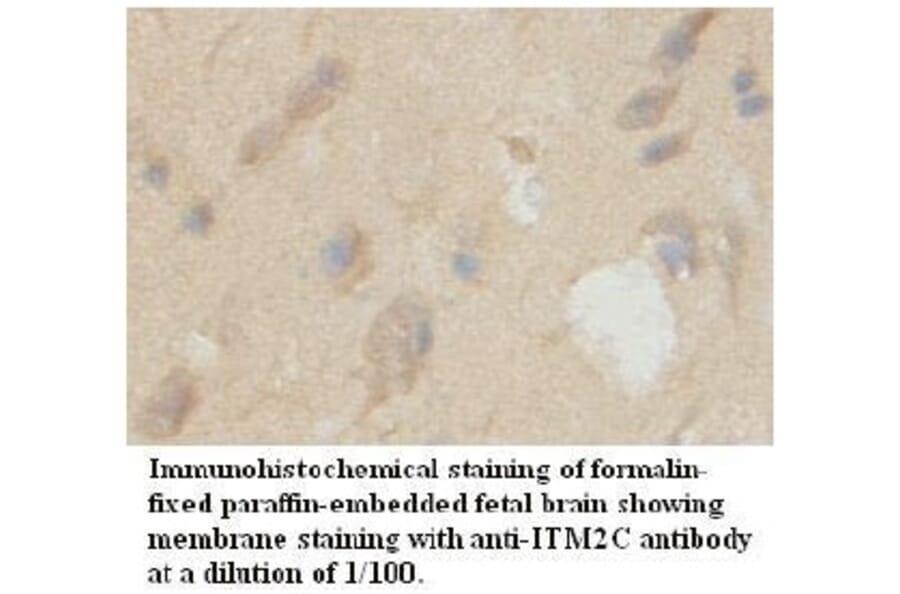 ITM2C Antibody from Signalway Antibody (39725) - Antibodies.com