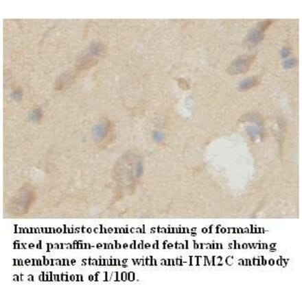ITM2C Antibody from Signalway Antibody (39725) - Antibodies.com