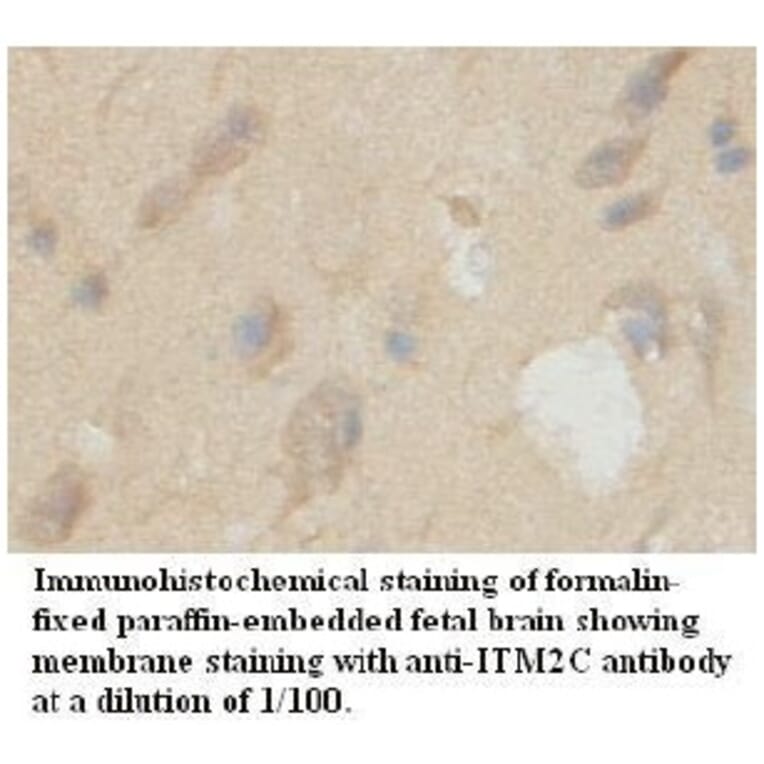 ITM2C Antibody from Signalway Antibody (39725) - Antibodies.com