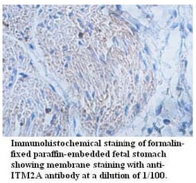 ITM2A Antibody from Signalway Antibody (39726) - Antibodies.com