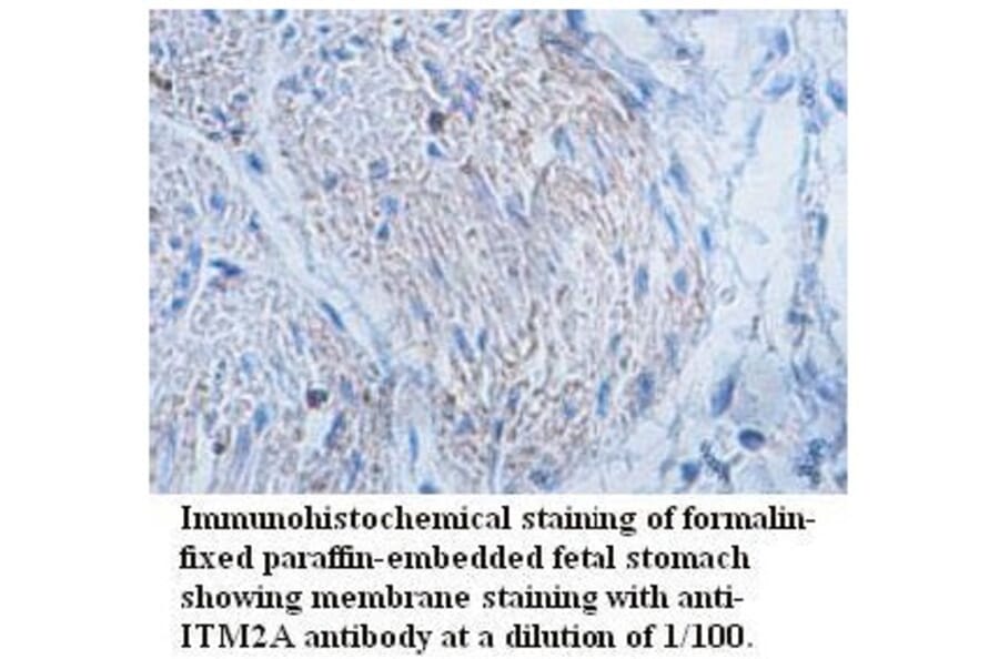 ITM2A Antibody from Signalway Antibody (39726) - Antibodies.com