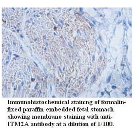 ITM2A Antibody from Signalway Antibody (39726) - Antibodies.com