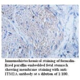 ITM2A Antibody from Signalway Antibody (39726) - Antibodies.com