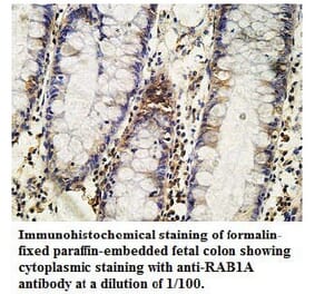 RAB1A Antibody from Signalway Antibody (39737) - Antibodies.com