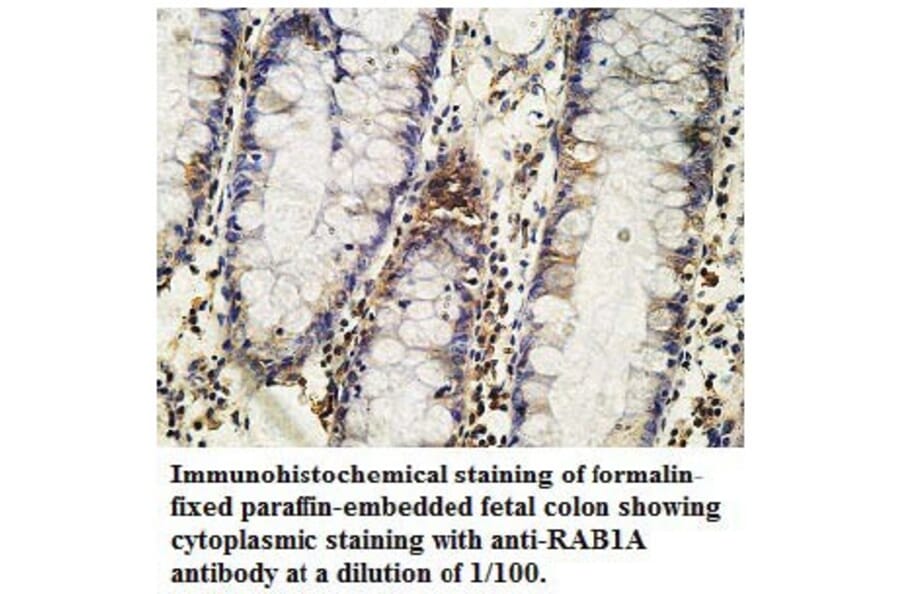 RAB1A Antibody from Signalway Antibody (39737) - Antibodies.com