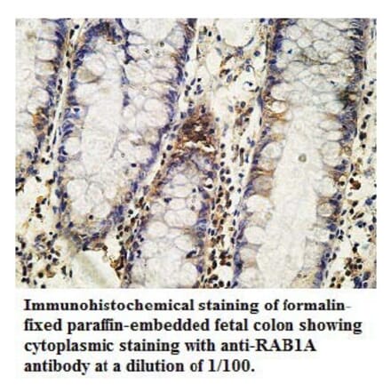 RAB1A Antibody from Signalway Antibody (39737) - Antibodies.com