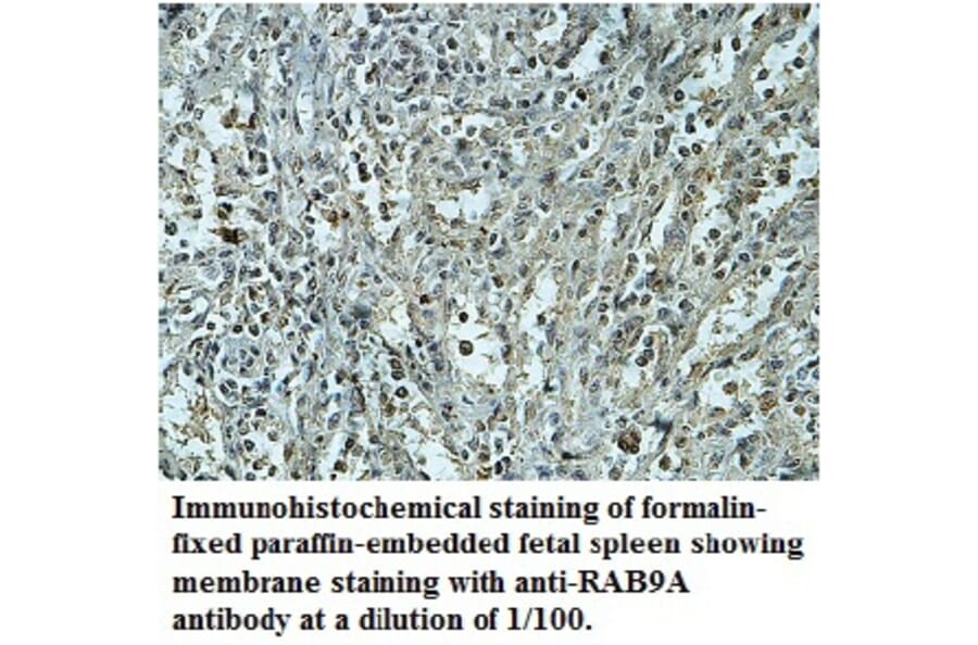 RAB9A Antibody from Signalway Antibody (39742) - Antibodies.com