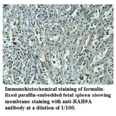 RAB9A Antibody from Signalway Antibody (39742) - Antibodies.com