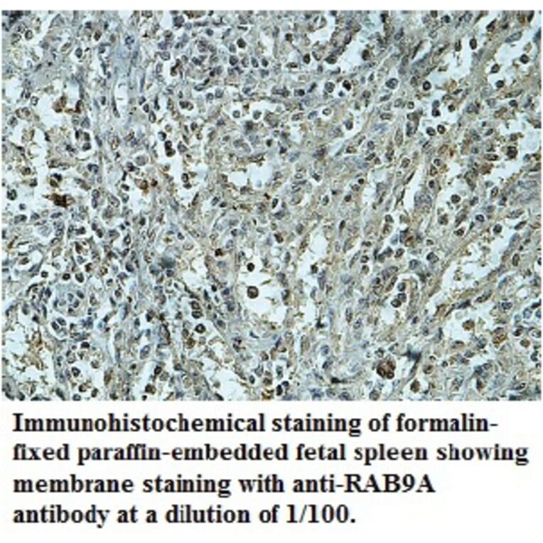 RAB9A Antibody from Signalway Antibody (39742) - Antibodies.com