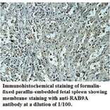 RAB9A Antibody from Signalway Antibody (39742) - Antibodies.com