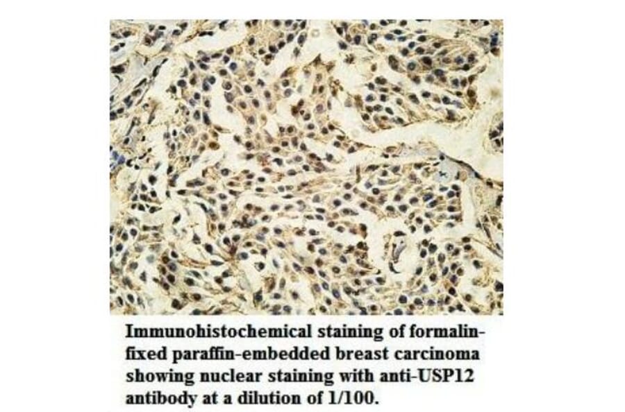 USP12 Antibody from Signalway Antibody (39921) - Antibodies.com