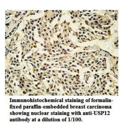 USP12 Antibody from Signalway Antibody (39921) - Antibodies.com