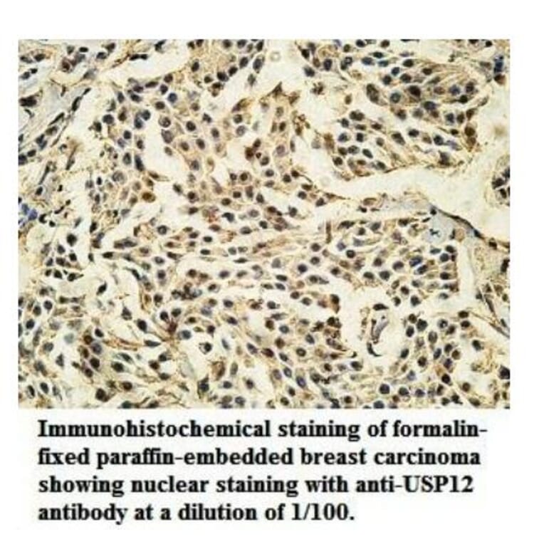 USP12 Antibody from Signalway Antibody (39921) - Antibodies.com