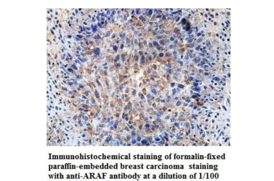 ARAF Antibody from Signalway Antibody (39929) - Antibodies.com