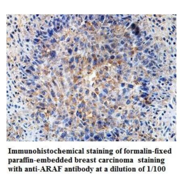 ARAF Antibody from Signalway Antibody (39929) - Antibodies.com