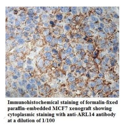 ARL14 Antibody from Signalway Antibody (39938) - Antibodies.com