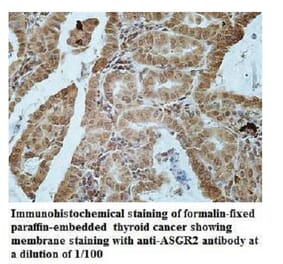 ASGR2 Antibody from Signalway Antibody (39942) - Antibodies.com