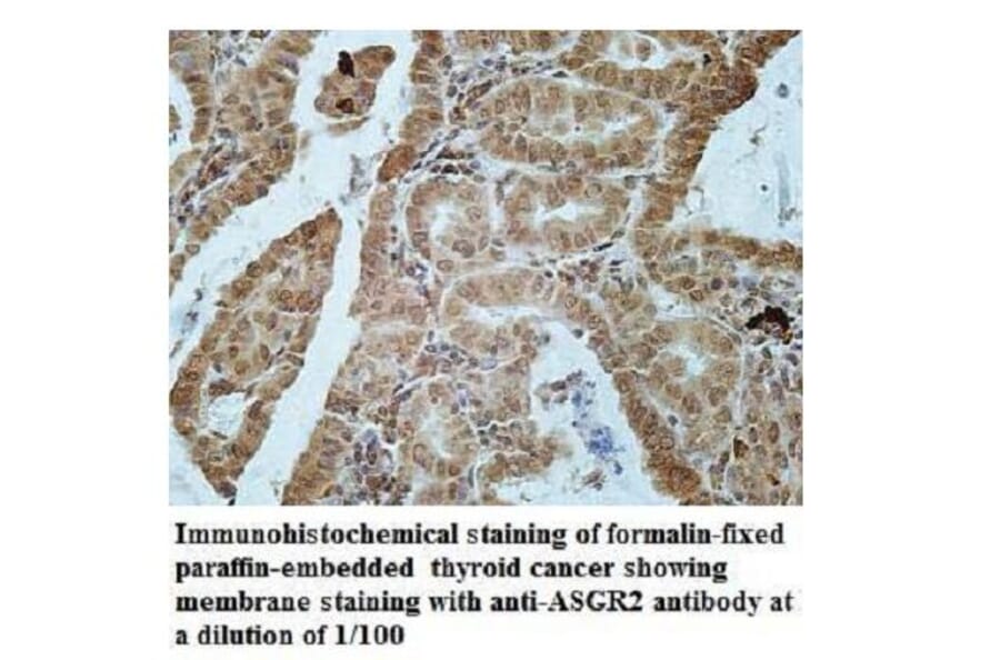ASGR2 Antibody from Signalway Antibody (39942) - Antibodies.com