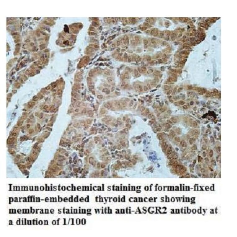 ASGR2 Antibody from Signalway Antibody (39942) - Antibodies.com