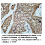 ASGR2 Antibody from Signalway Antibody (39942) - Antibodies.com