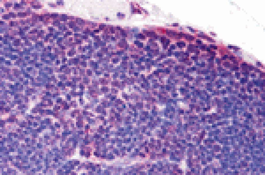 Immunohistochemistry - TLR8 Antibody from Signalway Antibody (24232) - Antibodies.com