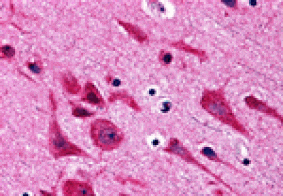 Immunohistochemistry - TAB2 Antibody from Signalway Antibody (25440) - Antibodies.com