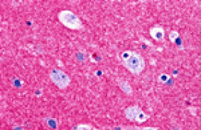 Immunohistochemistry - RIM2 Antibody from Signalway Antibody (25445) - Antibodies.com