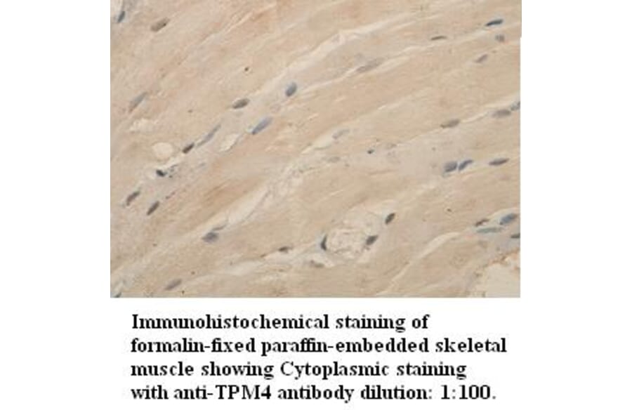TPM4 Antibody from Signalway Antibody (39336) - Antibodies.com