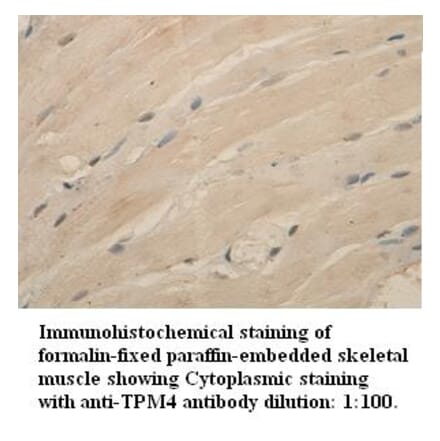 TPM4 Antibody from Signalway Antibody (39336) - Antibodies.com