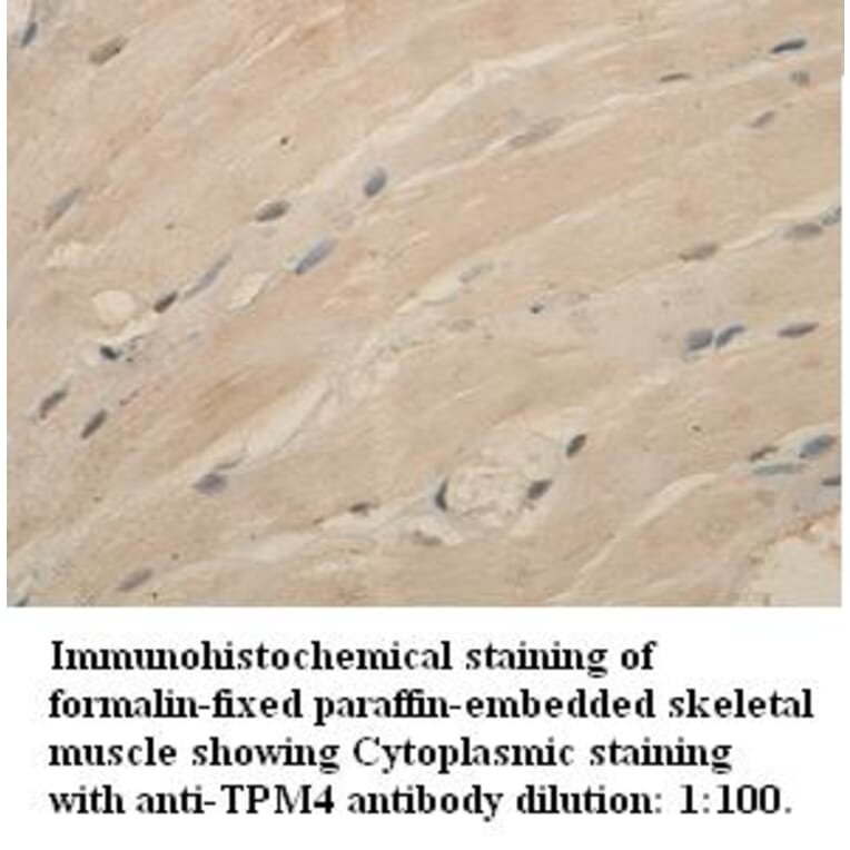 TPM4 Antibody from Signalway Antibody (39336) - Antibodies.com
