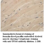 TPM4 Antibody from Signalway Antibody (39336) - Antibodies.com