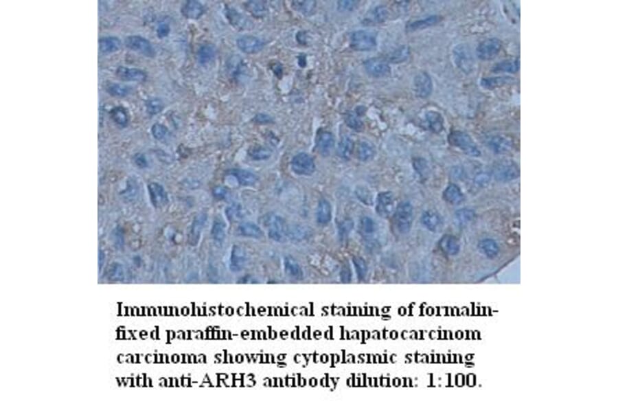ARH3 Antibody from Signalway Antibody (39346) - Antibodies.com
