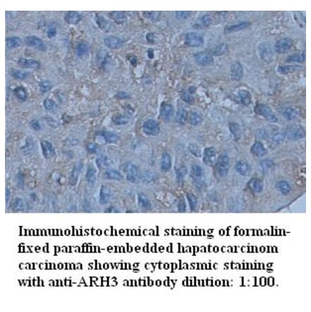 ARH3 Antibody from Signalway Antibody (39346) - Antibodies.com