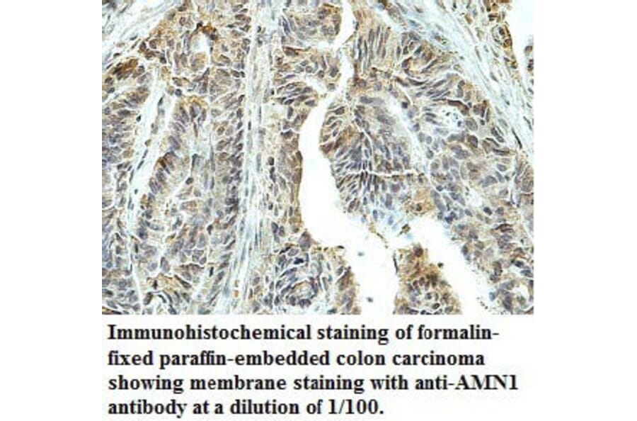 AMN1 Antibody from Signalway Antibody (39755) - Antibodies.com